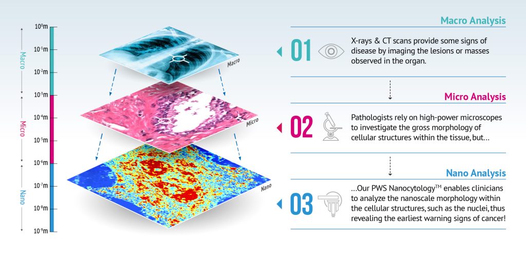 Micro-infographics sample in medical